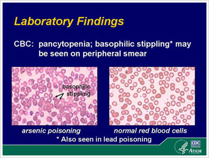 las conclusiones del laboratorio de envenenar de ars%26eacute;nico y gl%26oacute;bulos rojos normales