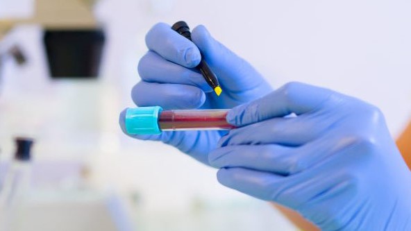 Woman in rubber gloves holding a vial of blood.